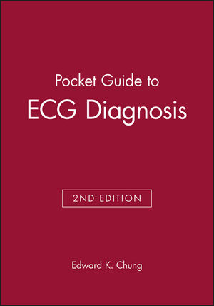 Pocket Guide to ECG Diagnosis, 2nd Edition (0865425892) cover image