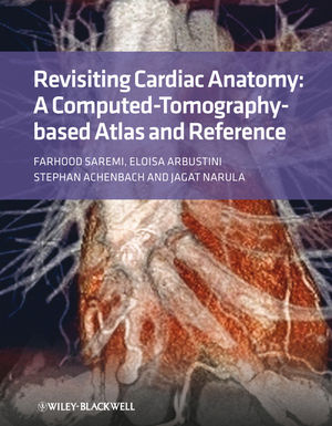 Revisiting Cardiac Anatomy: A Computed-Tomography-Based Atlas and Reference (1405194693) cover image