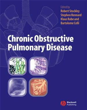 Chronic Obstructive Pulmonary Disease (1405122897) cover image