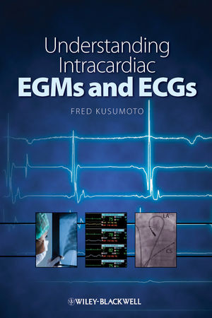 Understanding Intracardiac EGMs and ECGs (1444360698) cover image