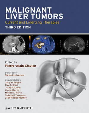 Malignant Liver Tumors: Current and Emerging Therapies, 3rd Edition (1444356399) cover image