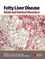 Fatty Liver Disease: NASH and Related Disorders (1405112921) cover image