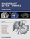 Malignant Liver Tumors: Current and Emerging Therapies, 3rd Edition (1405179767) cover image