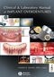 Clinical and Laboratory Manual of Implant Overdentures (0813808812) cover image