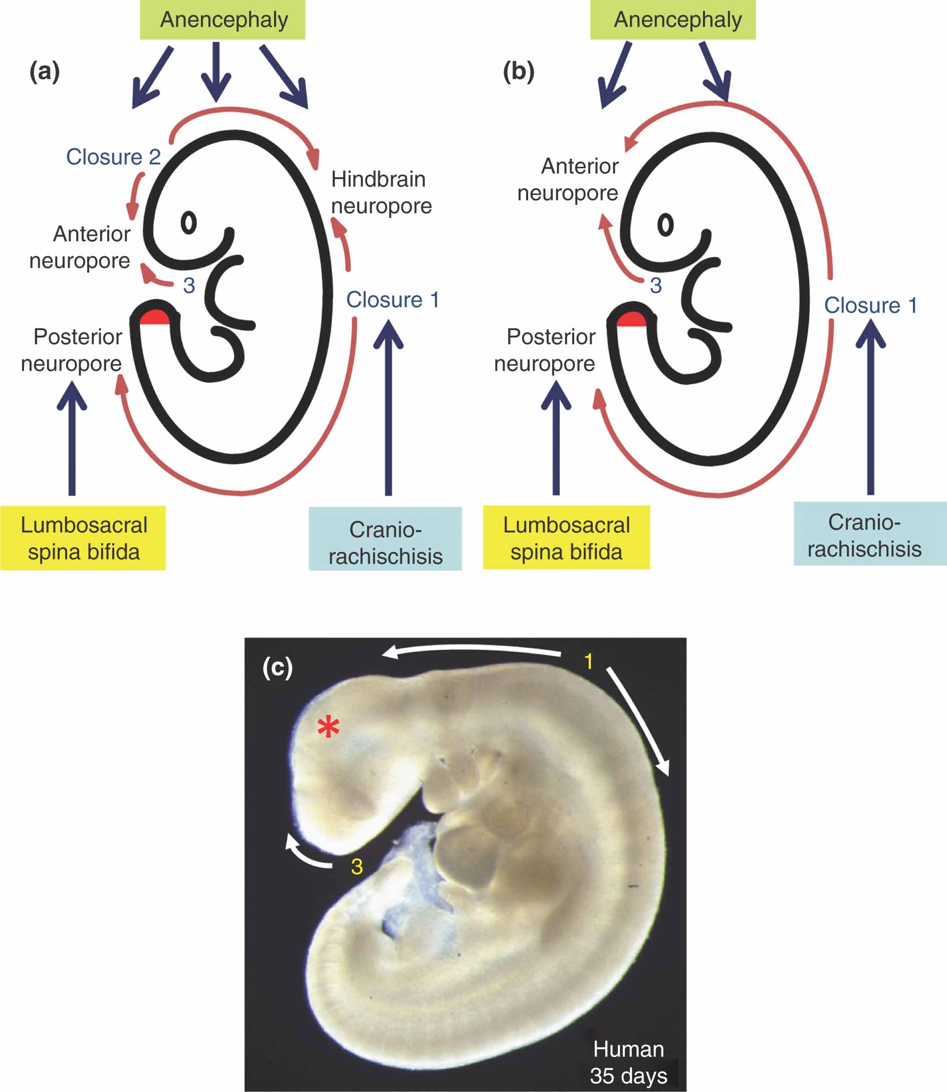 Human Neurulation