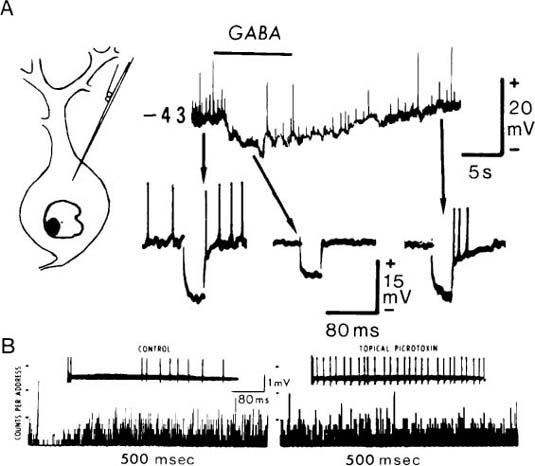 Scalp Acupuncture Multiple Sclerosis Scalp Acupuncture Multiple Sclerosis