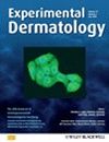 Experimental Dermatology