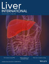 Liver International