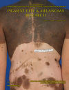 Pigment Cell & Melanoma Research