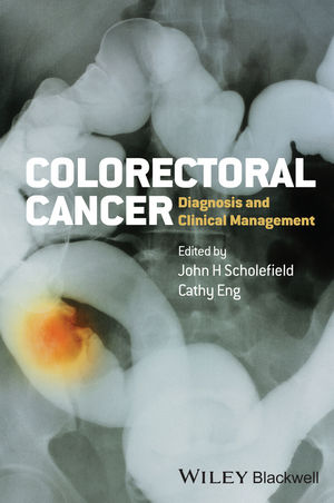 Colorectal Cancer: Diagnosis and Clinical Management