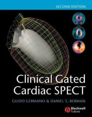 Clinical Gated Cardiac SPECT, 2nd Edition