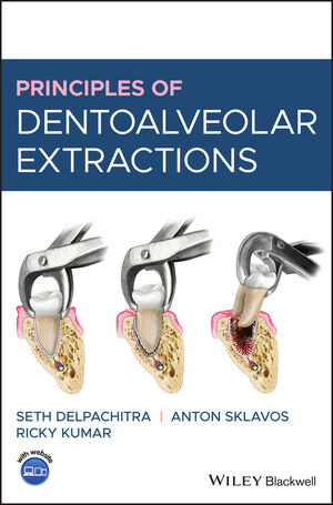 Microsurgery in Endodontics | Wiley