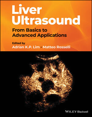 Liver Ultrasound: From Basics to Advanced Applications cover image