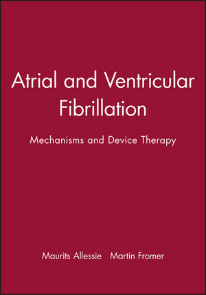 Clinical Electrocardiography: A Textbook, 4th Edition | Wiley