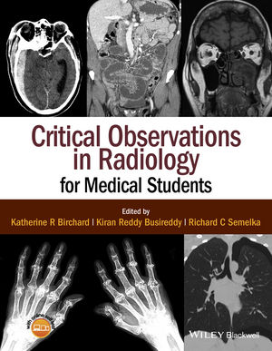 Critical Observations in Radiology for Medical Students cover image