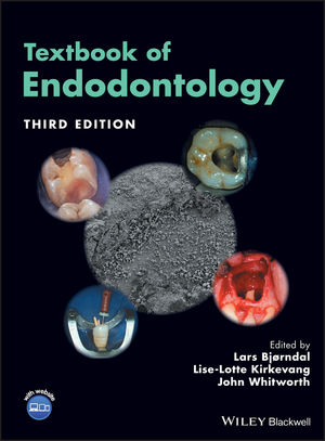 Endodontic Advances and Evidence-Based Clinical Guidelines | Wiley