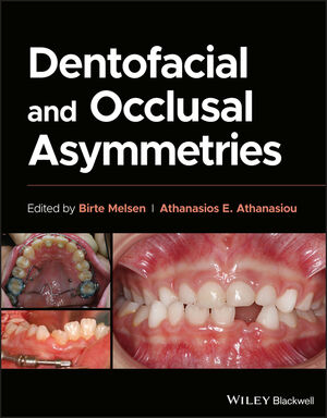 Dentofacial and Occlusal Asymmetries