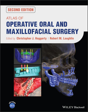 Atlas of Operative Oral and Maxillofacial Surgery, 2nd Edition cover image