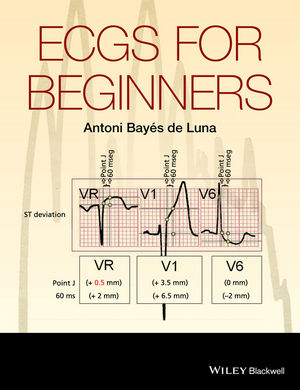 ecg interpretation pdf free download