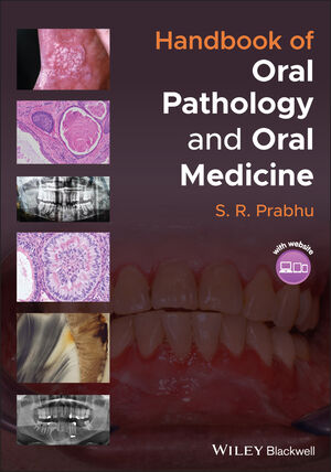 Handbook of Oral Pathology and Oral Medicine cover image