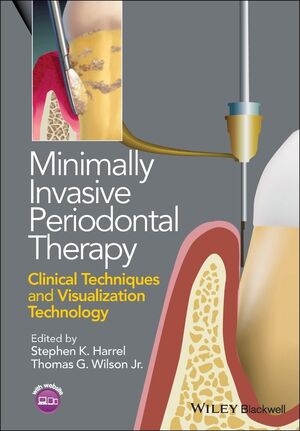 Minimally Invasive Periodontal Therapy: Clinical Techniques and Visualization Technology (2015) by Stephen K. Harrel