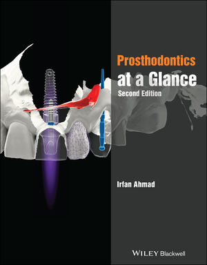 The Art of Learning Preclinical Prosthodontics (Paperback