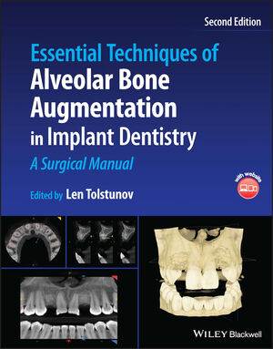 Essential Techniques of Alveolar Bone Augmentation in Implant Dentistry: A Surgical Manual, 2nd Edition cover image