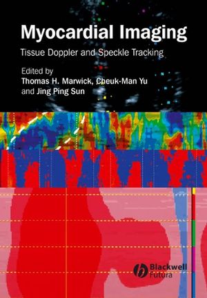 Myocardial Imaging: Tissue Doppler and Speckle Tracking