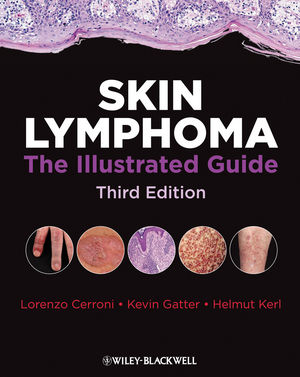 Skin Lymphoma: The Illustrated Guide, 3rd Edition
