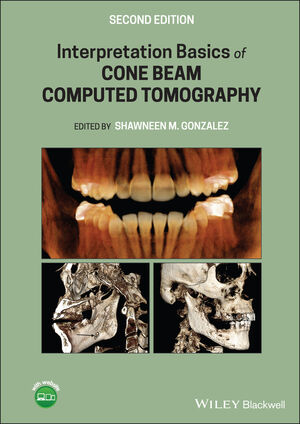 Interpretation Basics of Cone Beam Computed Tomography, 2nd Edition cover image