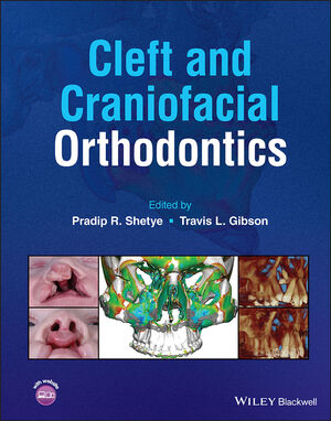 Cleft and Craniofacial Orthodontics cover image