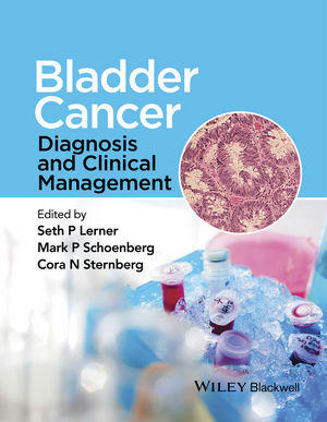 Bladder Cancer: Diagnosis and Clinical Management
