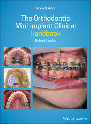 The Orthodontic Mini-implant Clinical Handbook, 2nd Edition | Wiley