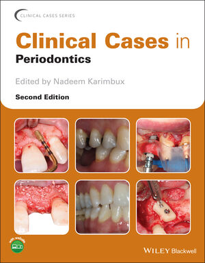 Clinical Cases in Periodontics, 2nd Edition cover image
