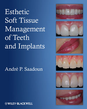 裁断済み】Manual of Soft-tissue Management www