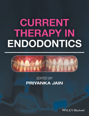Endodontic Advances and Evidence-Based Clinical Guidelines | Wiley
