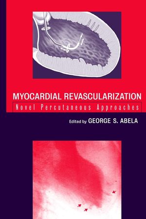 Myocardial Revascularization: Novel Percutaneous Approaches