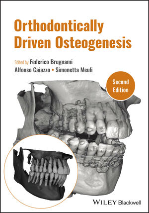 Orthodontically Driven Osteogenesis, 2nd Edition