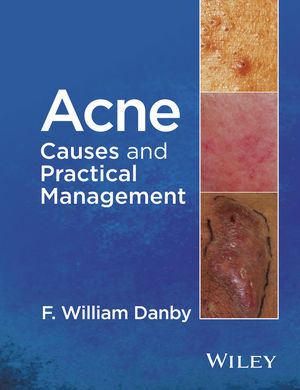 Acne causes and practical management pdf download browser update android