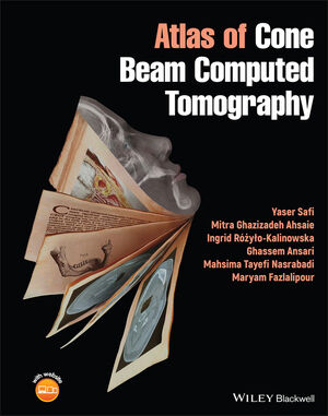Atlas of Cone Beam Computed Tomography cover image