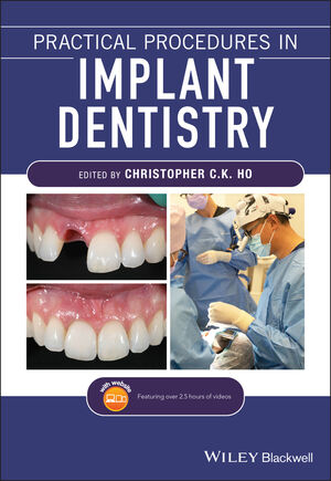 Practical Procedures in Implant Dentistry cover image