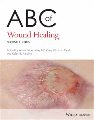 ABC of Wound Healing, 2nd Edition
