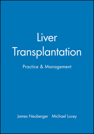 Liver Transplantation: Practice and Management