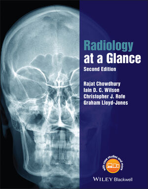 Radiology at a Glance, 2nd Edition cover image