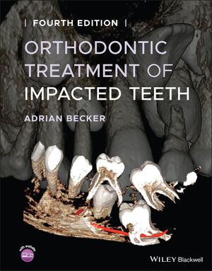 Orthodontic Treatment of Impacted Teeth, 4th Edition cover image