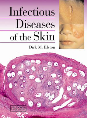 Rook's Textbook of Dermatology, 8th Edition | Wiley