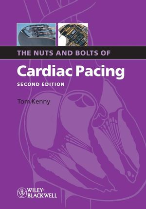 The Nuts and Bolts of Cardiac Pacing, 2nd Edition