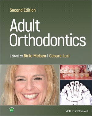 Adult Orthodontics, 2nd Edition cover image