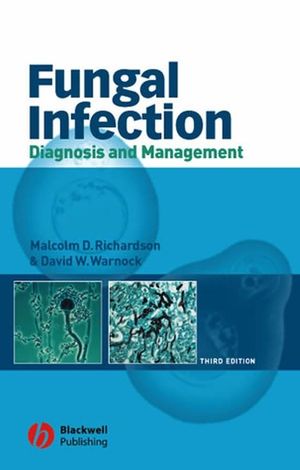 Fungal Infection: Diagnosis and Management