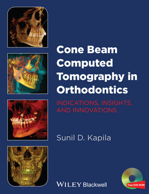 Microsurgery in Endodontics | Wiley Microsurgery in Endodontics | Wiley